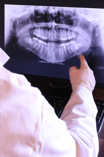 Best Broken or Cracked Tooth Emergency Dentist in Chula Vista, CA